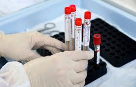 В Україні готуються запустити тестування на антитіла до COVID-19
